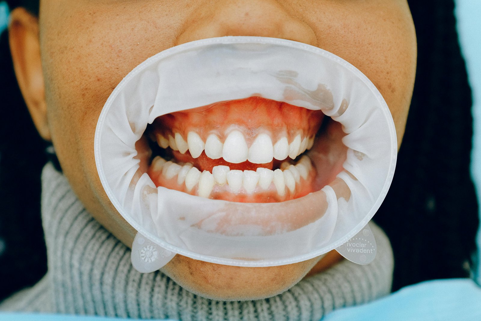 Mouth-mirror exam