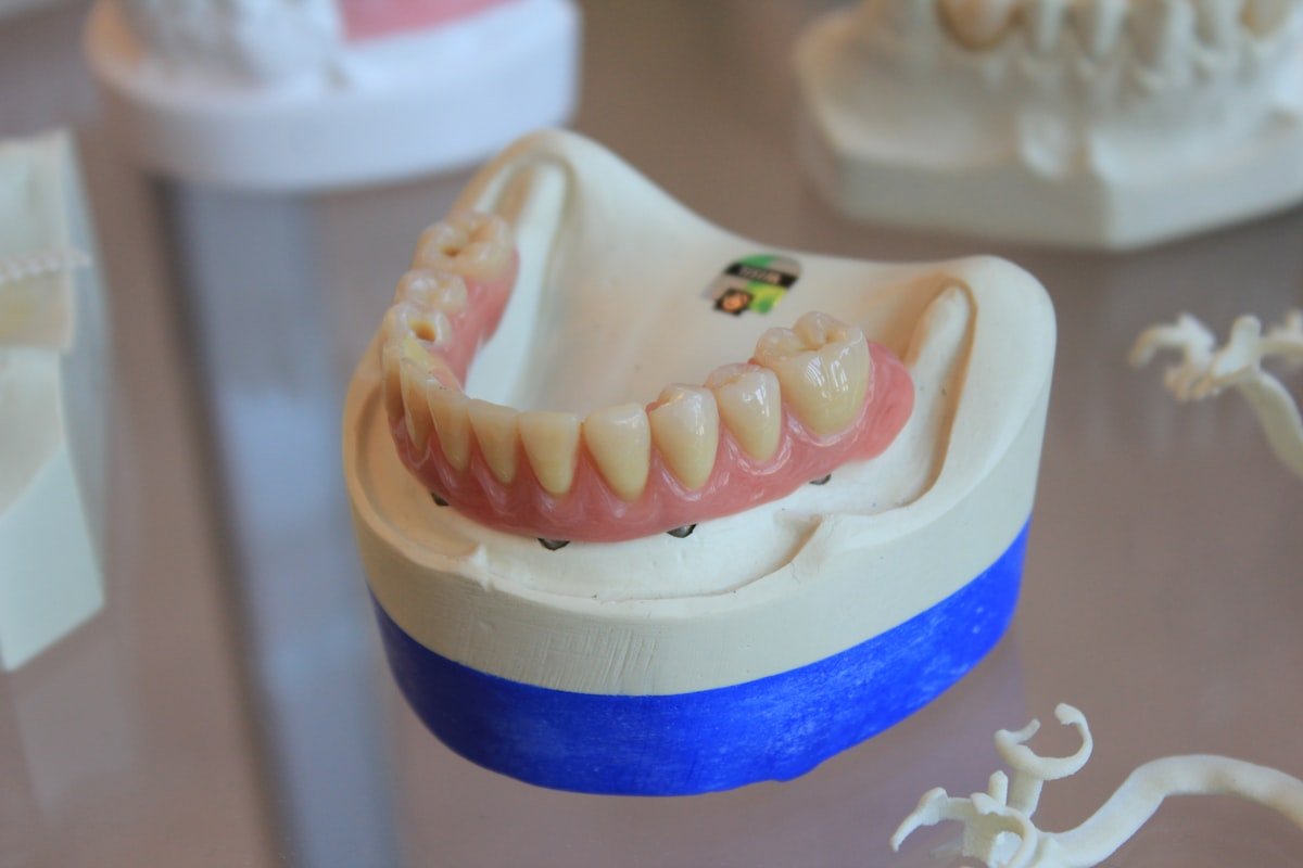 Dentures — anatomical illustration