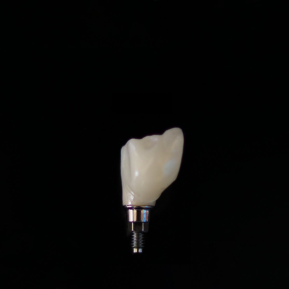 Tooth anatomy cross-section