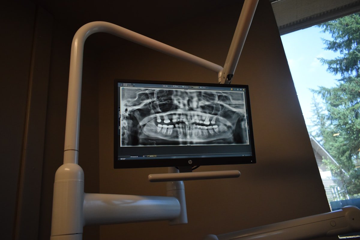 Dentist reviewing a CBCT 3D dental scan on a clinic monitor