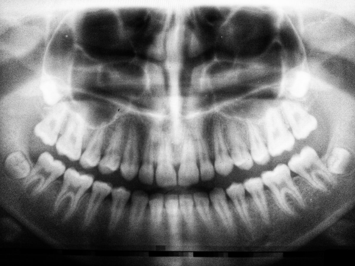 Panoramic dental x-ray showing healthy jaw structure